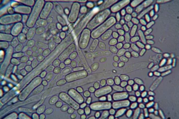 Keith Beavers Investigates the Science Behind Wine’s Sugar Fungus